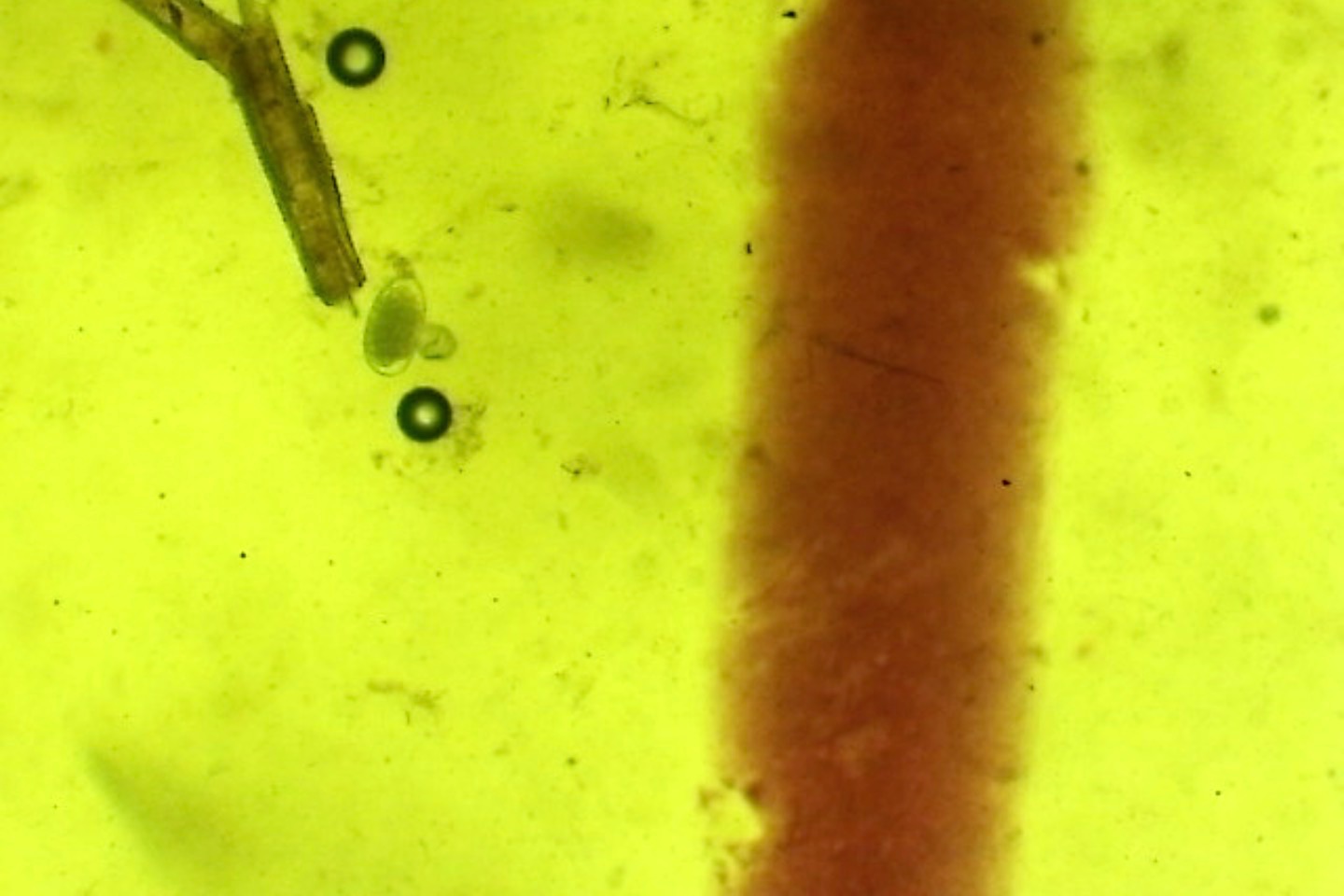 Why do a Faecal Worm Egg Count? 